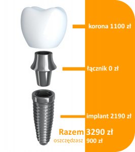 implant łącznik korona promocja 3290 zł