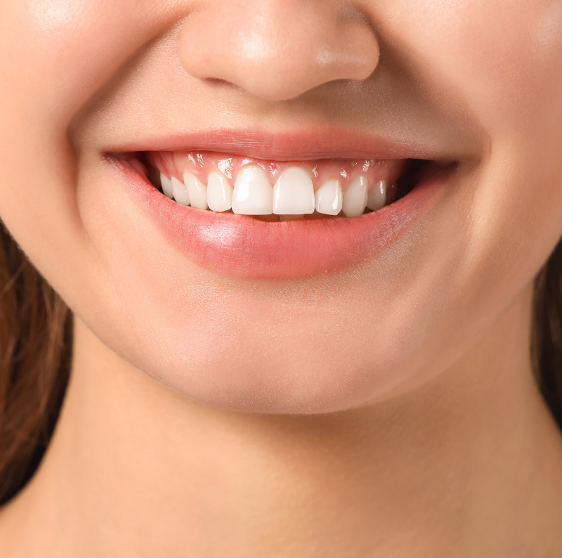 Projekt bez nazwy (11)